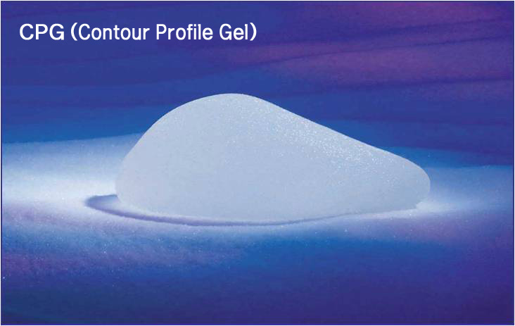 チェストインプラント（MENTOR）